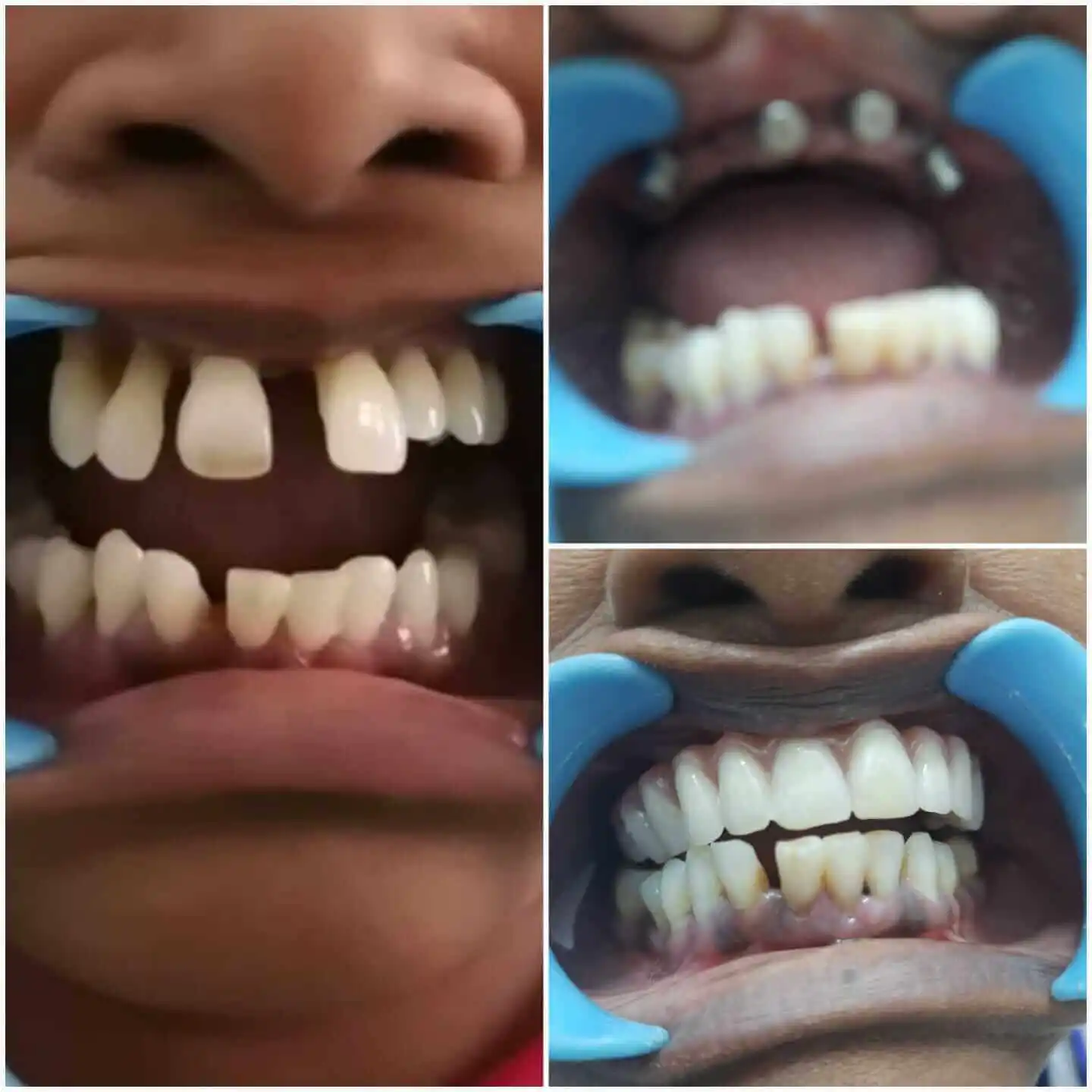AV Dental Clinic Dental Unit