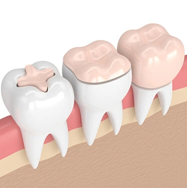 AV Dental Clinic Biomimetics Dentistry